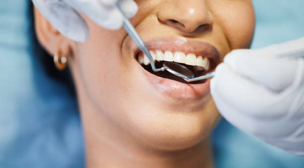 Best Emergency Treatment for Dental Infections or Abscesses in Logansport, IN